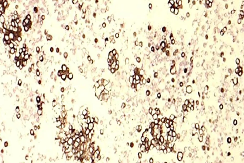 Cytokeratin 7​