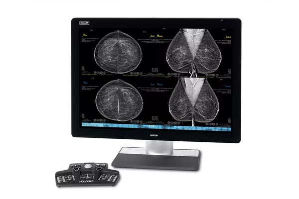 Breast imaging diagnostic workstation